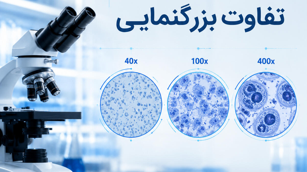 تفاوت بزرگنمایی ۴۰برابر، ۱۰۰برابر و ۴۰۰برابر میکروسکوپ؛ کدام برای شما مناسب است؟